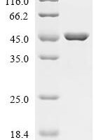 Mouse Ubiquitin-like domain-containing CTD phosphatase 1 (Ublcp1) Recombinant Protein - BioCrest Sci