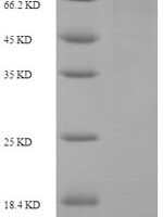 Escherichia coli ATP-dependent DNA helicase recG (recG) Recombinant Protein - BioCrest Sci