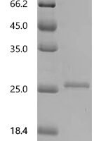 Human immunodeficiency virus type 1 group M subtype B Gag polyprotein (gag), partial Recombinant Protein, C-His, aa 133–363, Human immunodeficiency virus type 1 group M subtype B (isolate NY5) (HIV-1) - BioCrest Sci