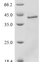 Reovirus type 3 Outer capsid protein sigma-3 (S4) Recombinant Protein, N-His - BioCrest Sci