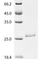 Human Ras-related C3 botulinum toxin substrate 1 (RAC1) Recombinant Protein, C-His - BioCrest Sci