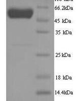 Danio rerio D-2-hydroxyglutaRate dehydrogenase, mitochondrial (d2hgdh) Recombinant Protein - BioCrest Sci
