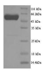 Danio rerio D-2-hydroxyglutaRate dehydrogenase, mitochondrial (d2hgdh) Recombinant Protein, Danio rerio (Zebrafish) (Brachydanio rerio), Yeast, N-terminal 6xHis-tagged, 54.3 kDa, purity >≥ 90% as determined by SDS-PAGE.