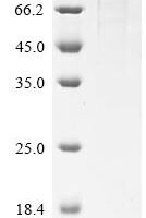 Human Interleukin-12 receptor subunit beta-1 (IL12RB1), partial Recombinant Protein, C-hFc1 - BioCrest Sci