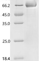 Macaca fascicularis Kallikrein related peptidase 5 (KLK5), partial Recombinant Protein, C-hFc1 - BioCrest Sci