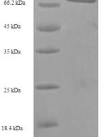 Human herpesvirus 1 Tegument protein VP16 (UL48) Recombinant Protein - BioCrest Sci