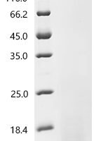 Chicken Pro-epidermal growth factor (EGF), partial Recombinant Protein - BioCrest Sci