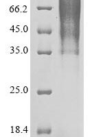 Human SARS coronavirus Spike glycoprotein (S), partial Recombinant Protein, N-His - BioCrest Sci
