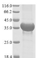 Human Deoxycytidine kinase (DCK) Recombinant Protein - BioCrest Sci
