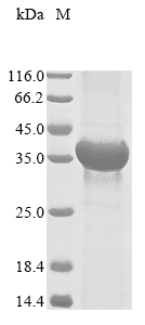 Human Deoxycytidine kinase (DCK) Recombinant Protein, Homo sapiens (Human), E.coli, N-terminal 10xHis-tagged and C-terminal Myc-tagged, 35.5 kDa, purity >≥ 85% as determined by SDS-PAGE.