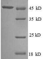 Escherichia coli Probable diguanylate cyclase DgcQ (dgcQ), partial, partial Recombinant Protein - BioCrest Sci