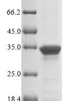 Mycoplasma pneumoniae ADP-ribosylating toxin CARDS (cards), partial Recombinant Protein - BioCrest Sci