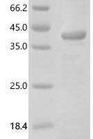 Human 3-ketoacyl-CoA thiolase, peroxisomal (ACAA1) Recombinant Protein - BioCrest Sci