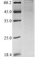 Human Complement C1s subcomponent (C1S) Recombinant Protein - BioCrest Sci