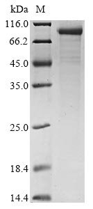 Human Complement C1s subcomponent (C1S) Recombinant Protein, Homo sapiens (Human), E.coli, N-terminal 10xHis-tagged, 80.9 kDa, purity >≥ 85% as determined by SDS-PAGE.