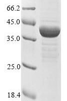 Human Acetyl-CoA acetyltransferase, mitochondrial (ACAT1) Recombinant Protein, C-His - BioCrest Sci