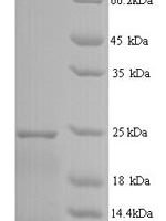 Human Interferon alpha-14 (IFNA14) Recombinant Protein, N-His - BioCrest Sci