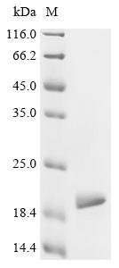 Human Microtubule-associated protein tau (MAPT), partial Recombinant Protein, Homo sapiens (Human), E.coli, N-terminal 10xHis-tagged and C-terminal Myc-tagged, 17.6 kDa, purity >≥ 95% as determined by SDS-PAGE.