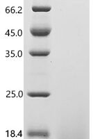 Human Guanine nucleotide-binding protein G (q) subunit alpha (GNAQ), partial Recombinant Protein, C-His - BioCrest Sci