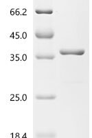 Mycobacterium tuberculosis Co-chaperonin GroES (groES) Recombinant Protein, N-GST - BioCrest Sci