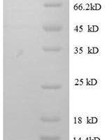 Human Interleukin-8 (CXCL8), partial Recombinant Protein, N-His, aa 28–99 - BioCrest Sci
