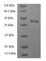 Human Endothelial cell-selective adhesion molecule (ESAM), partial Recombinant Protein - BioCrest Sci