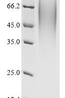 Porcellio dilatatus Androgenic gland hormone (AGH), partial Recombinant Protein - BioCrest Sci