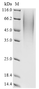 Porcellio dilatatus Androgenic gland hormone (AGH), partial Recombinant Protein, Porcellio dilatatus (Woodlouse), Yeast, C-terminal 6xHis-tagged, 6.6 kDa, purity >≥ 90% as determined by SDS-PAGE.