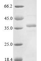 Human respiratory syncytial virus B Major surface glycoprotein G (G), partial Recombinant Protein - BioCrest Sci