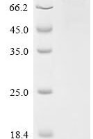 Human NAD-dependent protein deacetylase sirtuin-1 (SIRT1) Recombinant Protein, C-His, aa 2–747, Mammalian cell - BioCrest Sci
