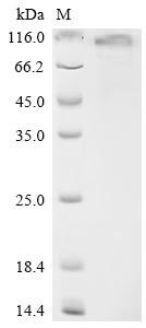 Human NAD-dependent protein deacetylase sirtuin-1 (SIRT1) Recombinant Protein, C-His, aa 2–747, Mammalian cell, Homo sapiens (Human), Mammalian cell, C-terminal 6xHis-tagged, 83.3 kDa, purity >≥ 90% as determined by SDS-PAGE.