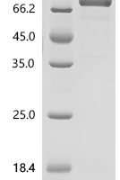 Human Prothrombin (F2) Recombinant Protein, C-10His - BioCrest Sci