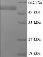 Human Isocitrate dehydrogenase [NAD] subunit gamma, mitochondrial (IDH3G) Recombinant Protein - BioCrest Sci