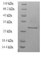 Pinctada fucata N16.1 matrix protein Recombinant Protein, N-His-SUMO - BioCrest Sci