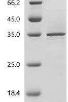 Human Cyclin-dependent kinase 12 (CDK12), partial Recombinant Protein, N-His - BioCrest Sci