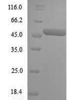 Acetobacter pasteurianus Modification methylase ApaLI (apaLIM) Recombinant Protein, N-His - BioCrest Sci