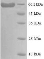 Human Delta-like protein 3 (DLL3), partial Recombinant Protein, N-His-SUMO - BioCrest Sci