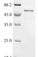 Mouse Cis-aconitate decarboxylase (Acod1) Recombinant Protein, N-His - BioCrest Sci