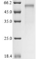 Human Cellular tumor antigen p53 (TP53) (R273H) Recombinant Protein - BioCrest Sci