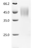 Rat Chromosome X open reading frame, human CXorf65 (Il2rg), partial Recombinant Protein - BioCrest Sci