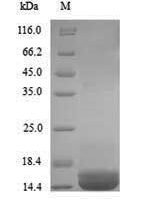 Human Apolipoprotein B-100 (APOB), partial Recombinant Protein, N-His - BioCrest Sci