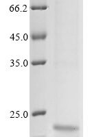Hepatitis B virus genotype B/C subtype adw External core antigen (C), partial Recombinant Protein, N-10His - BioCrest Sci