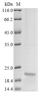 Hepatitis B virus genotype B/C subtype adw External core antigen (C), partial Recombinant Protein, N-10His, Hepatitis B virus genotype B/C subtype adw (isolate Okinawa/pODW282/1998) (HBV-B), Baculovirus, N-terminal 10xHis-tagged, 21.1 kDa, purity >≥ 85% as determined by SDS-PAGE.