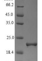 Rat Frataxin, mitochondrial (Fxn) Recombinant Protein, N-10His - BioCrest Sci