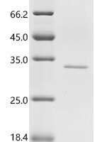 Human Transcriptional enhancer factor TEF-3 (TEAD4), partial Recombinant Protein, N-His - BioCrest Sci