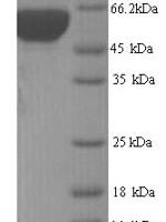 Yersinia pestis 60 kDa chaperonin (groL) Recombinant Protein, N-His - BioCrest Sci