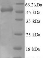 Human Heterogeneous nuclear ribonucleoprotein Q (SYNCRIP), partial Recombinant Protein - BioCrest Sci