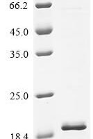 Human Protein FAM171A2 (FAM171A2), partial Recombinant Protein - BioCrest Sci