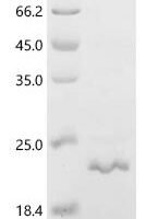 Human Matrix-remodeling-associated protein 5 (MXRA5), partial Recombinant Protein - BioCrest Sci