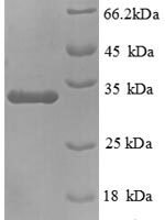 Mouse Mucin-2 (Muc5ac), partial Recombinant Protein - BioCrest Sci